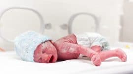 סיבוכים בלידה