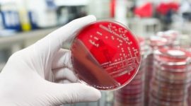 רשלנות בזיהומים