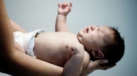 רשלנות מוהל בברית מילה