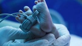 פיגור שכלי על רקע מצוקה עוברית