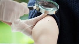 טיפול בנגע סרטני