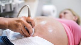 רשלנות הריון ולידה