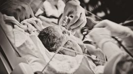 שיתוק מוחין מלידה