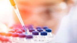 תסמונת אדוארדס