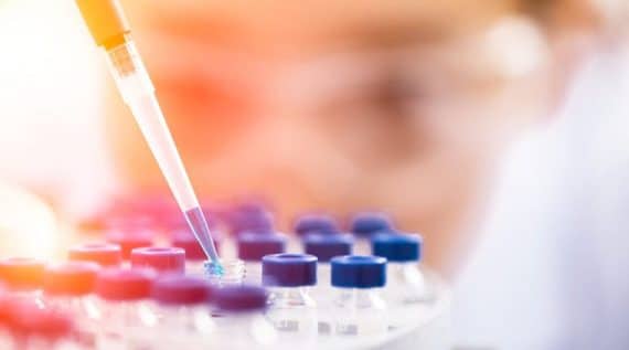 תסמונת אדוארדס