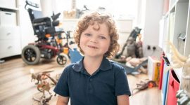 ניוון שרירים שדרתי