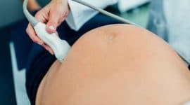 רשלנות רפואית בטיפול היפרדות שליה