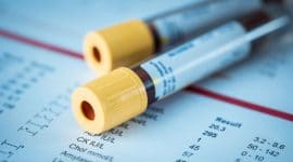 קרישה תוך כלית