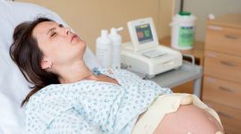 רשלנות מיילדת