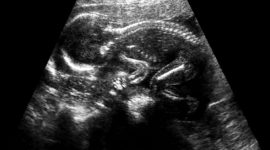 ספינה ביפידה