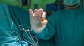 רשלנות בניתוח מסתם לב