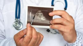 ציסטה בכליה